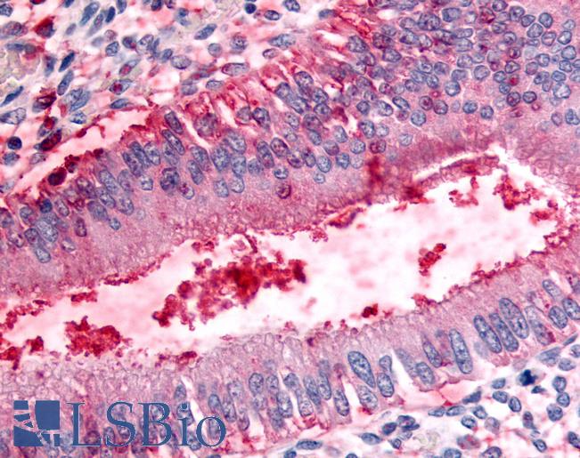 Anti-DPP8 antibody LS-A8039 IHC of human uterus. Immunohistochemistry of formalin-fixed, paraffin-embedded tissue after heat-induced antigen retrieval.