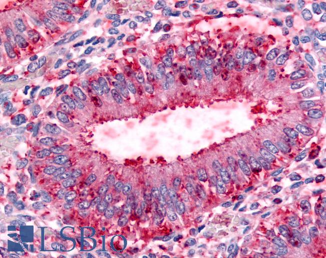 Anti-DPP8 antibody LS-A8034 IHC of human uterus, endometrial glands. Immunohistochemistry of formalin-fixed, paraffin-embedded tissue after heat-induced antigen retrieval.
