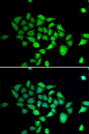 Immunofluorescence blot of A549 cell using DPP8 antibody. Blue: DAPI for nuclear staining.