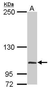 Sample (50 ug of whole cell lysate). A: Mouse brain. 5% SDS PAGE. Dipeptidylpeptidase 8 / DPP8 antibody diluted at 1:2000.