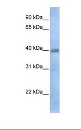 Fetal heart lysate. Antibody concentration: 1.0 ug/ml. Gel concentration: 12%.