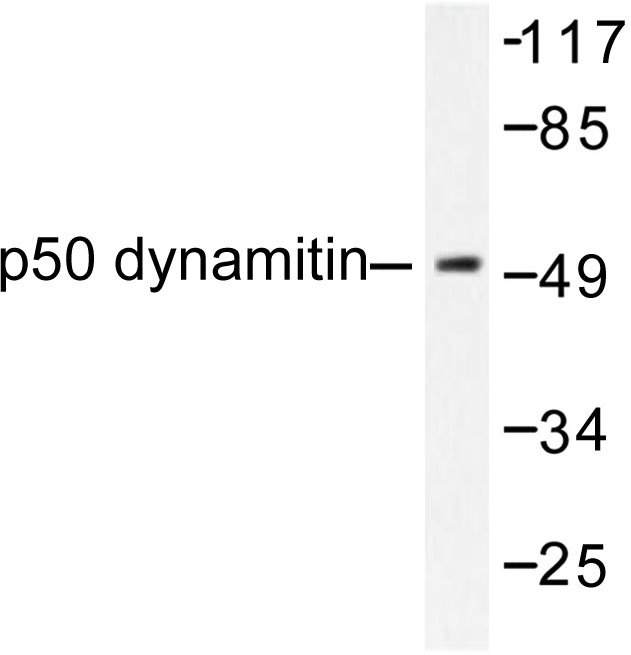 Western blot of p50 Dynamitin (L371) pAb in extracts from A549 cells.