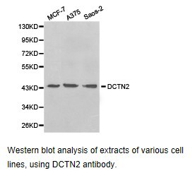 Western blot.