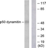 Western blot of extracts from A549 cells, using Dynamitin Antibody. The lane on the right is treated with the synthesized peptide.