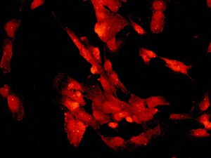 Immunofluorescent staining of SH-SY5Y cells using anti-DCTN2 antibody.