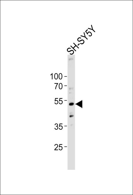 Western blot of lysate from SH-SY5Y cell line, using DCTN2 Antibody. Antibody was diluted at 1:1000 at each lane. A goat anti-rabbit IgG H&L (HRP) at 1:5000 dilution was used as the secondary antibody. Lysate at 35ug per lane.