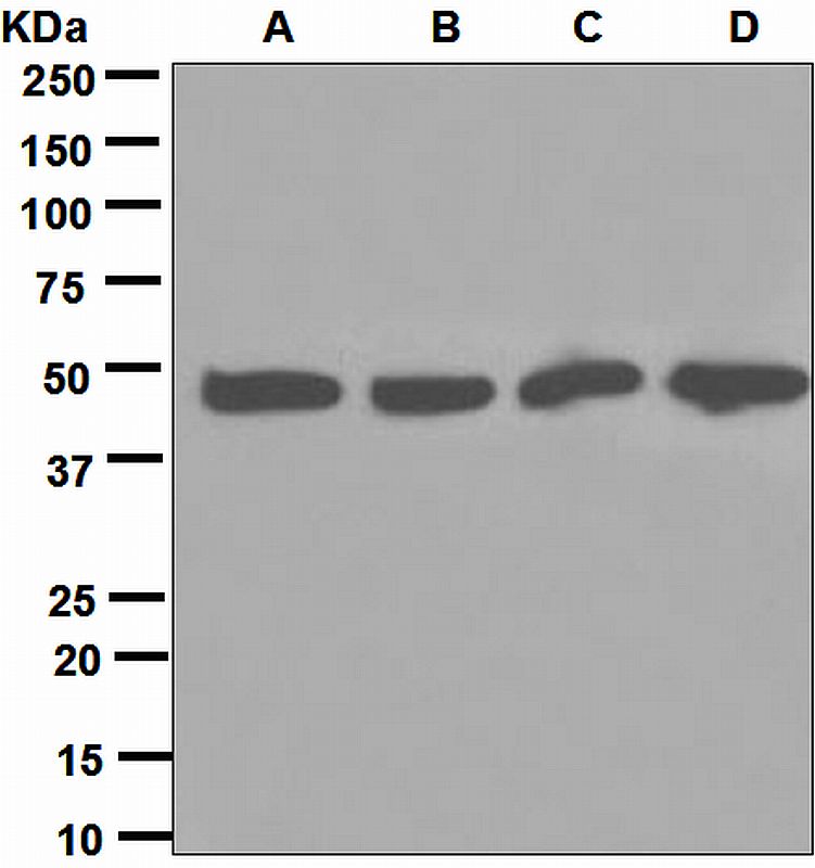 Western blot analysis on (A) MCF-7, (B) A375, (C) Saos-2, and (D) SH-SY5Y cell lysates using anti-DCTN2 antibody.