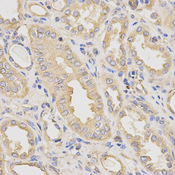 Immunohistochemistry of paraffin-embedded human kidney using DCTN2 antibody at dilution of 1:200 (x400 lens).