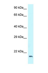 DCTN3 antibody LS-C145824 Western blot of 293T Cell lysate. Antibody concentration 1 ug/ml.