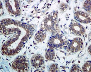 IHC of paraffin-embedded human breast tissue using anti-DCTN3 antibody.