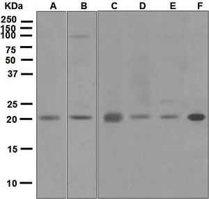 Western blot analysis on (A) 293T, (B) mouse muscle, (C) HeLa, (D) BxPC-3, (E) SH-SY5Y, and (F) rat muscle lysates using anti-DCTN3 antibody. Note: Dilute primary antibody in 1% BSA.