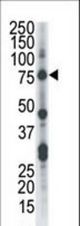 Western blot of anti-CLK2 antibody in HL-60 cell lysate. CLK2 (arrow) was detected using purified antibody. Secondary HRP-anti-rabbit was used for signal visualization with chemiluminescence.
