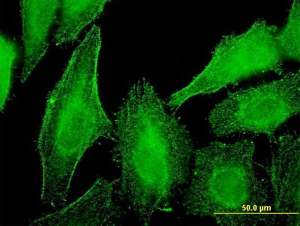 Immunofluorescence of monoclonal antibody to DST on HeLa cell . [antibody concentration 10 ug/ml]