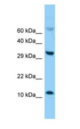 E-FABP / FABP5 antibody Western Blot of Mouse Thymus.