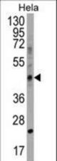 CHID1 Antibody western blot of HeLa cell line lysates (35 ug/lane). The CHID1 antibody detected the CHID1 protein (arrow).