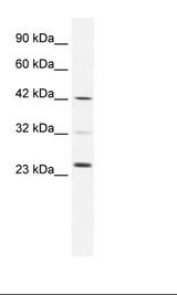 Daudi Cell Lysate