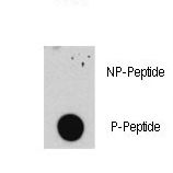 Dot blot of anti-E2F1-pS332 antibody (RB08110) on nitrocellulose membrane. 50ng of Phospho-peptide or Non Phospho-peptide per dot were adsorbed. Antibody working concentrations are 0.5ug per ml.