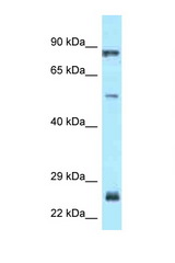 E2F1 antibody LS-C146077 Western blot of Fetal Lung lysate. Antibody concentration 1 ug/ml.