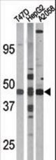 The anti-Phospho-E2F1-S337 antibody is used in Western blot to detect Phospho-E2F1-S337 in T47D(left), HepG2(middle), and A2058(right) tissue lysates