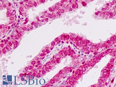 Human Prostate: Formalin-Fixed, Paraffin-Embedded (FFPE)