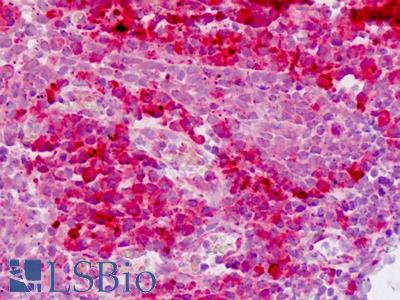 Human Tonsil: Formalin-Fixed, Paraffin-Embedded (FFPE)