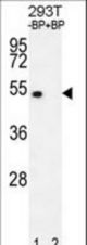 Western blot of E2F1 Antibody (H357) antibody pre-incubated without(lane 1) and with(lane 2) blocking peptide in 293T cell line lysate. E2F1 Antibody (H357) (arrow) was detected using the purified antibody.