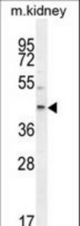 E2F2 Antibody western blot of mouse kidney tissue lysates (35 ug/lane). The E2F2 antibody detected the E2F2 protein (arrow).