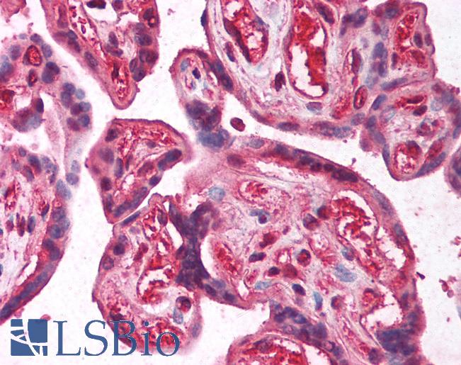 Anti-E2F2 antibody IHC of human placenta. Immunohistochemistry of formalin-fixed, paraffin-embedded tissue after heat-induced antigen retrieval. Antibody LS-B1521 concentration 5 ug/ml.