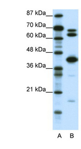 E2F2 antibody LS-B1521 Western blot of Jurkat lysate.