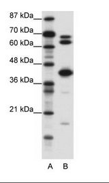 A: Marker, B: Jurkat Cell Lysate