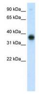 Western analysis of fetal thymus lysate.