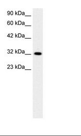 Jurkat Cell Lysate