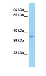 E2F5 antibody Western Blot of Mouse Pancreas . Antibody dilution: 1 ug/ml.