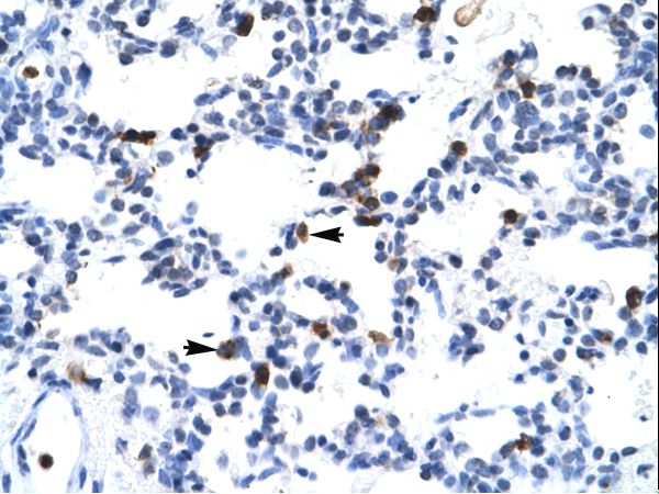 E2F6 antibody LS-C29812 was used in IHC to stain formalin-fixed, paraffin-embedded human lung.