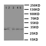 WB of E2F6 antibody. Lane 1: HELA Cell Lysate. Lane 2: COLO320 Cell Lysate. Lane 3: A549 Cell Lysate. Lane 4: MCF-7 Cell Lysate. Lane 5: SMMC Cell Lysate..