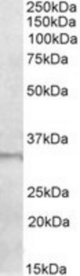 E2F6 antibody (1 ug/ml) staining of Human Skeletal Muscle lysate (35 ug protein in RIPA buffer). Primary incubation was 1 hour. Detected by chemiluminescence.