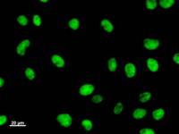 Immunostaining analysis in HeLa cells. HeLa cells were fixed with 4% paraformaldehyde and permeabilized with 0.1% Triton X-100 in PBS. The cells were immunostained with anti-E2F6 mAb.
