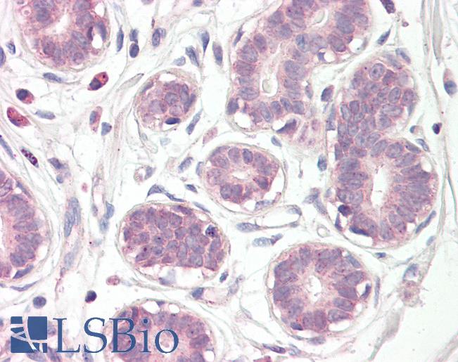 Anti-E2F6 antibody IHC of human breast. Immunohistochemistry of formalin-fixed, paraffin-embedded tissue after heat-induced antigen retrieval. Antibody LS-B8383 dilution 5 ug/ml.