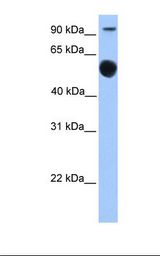 Fetal brain lysate. Antibody concentration: 1.0 ug/ml. Gel concentration: 12%.