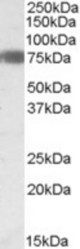 EBF1 antibody (0.3 ug/ml) staining of Human Adipose lysate (35 ug protein/ml in RIPA buffer). Primary incubation was 1 hour. Detected by chemiluminescence.