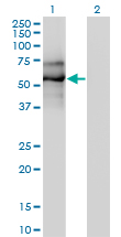 Western Blot analysis of EBF1 expression in transfected 293T cell line by EBF1 monoclonal antibody (M01), clone 1C12.Lane 1: EBF1 transfected lysate(64 KDa).Lane 2: Non-transfected lysate.