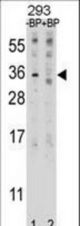 Western blot of EBI3 Antibody antibody pre-incubated without(lane 1) and with(lane 2) blocking peptide in 293 cell line lysate. EBI3 Antibody (arrow) was detected using the purified antibody.