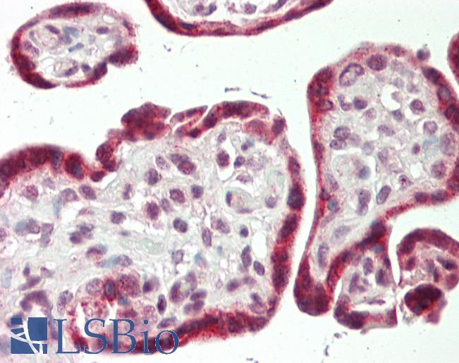 Human Placenta: Formalin-Fixed, Paraffin-Embedded (FFPE)