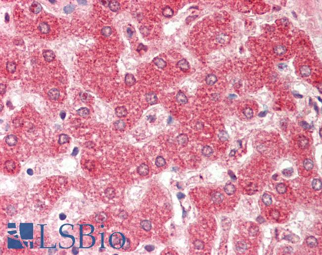 Anti-EBI3 antibody IHC staining of human liver. Immunohistochemistry of formalin-fixed, paraffin-embedded tissue after heat-induced antigen retrieval. Antibody LS-B9777 dilution 1:50.