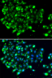 Immunofluorescence blot of MCF7 cell using NAT9 antibody. Blue: DAPI for nuclear staining.