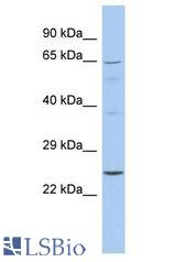 EBS / NAT9 antibody Western Blot of Fetal Spleen. Antibody dilution: 1 ug/ml.
