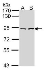 Sample (30 ug of whole cell lysate). A: Hela, B: Hep G2 . 7.5% SDS PAGE. CLLP / CTNNAL1 antibody diluted at 1:1000.
