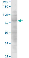 CTNNAL1 monoclonal antibody (M08), clone 3C8. Western blot of CTNNAL1 expression in Jurkat.