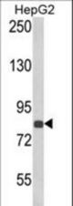 Western blot of ECE1 Antibody in HepG2 cell line lysates (35 ug/lane). ECE1 (arrow) was detected using the purified antibody.
