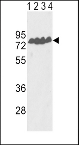 Western blot of ECE-1 Antibody in Y79(lane 1), T47D(lane 2) cell line and mouse lung(lane 3), liver(lane 4) tissue lysates (35 ug/lane). ECE-1 (arrow) was detected using the purified antibody.